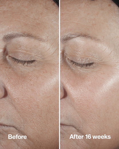Clinique Smart Clinical Repair™ Wrinkle Correcting Serum