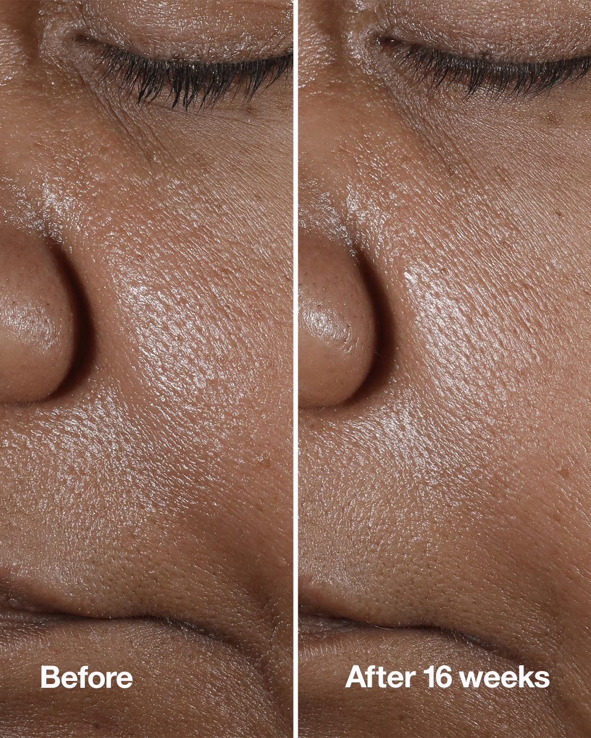 Clinique Smart Clinical Repair™ Wrinkle Correcting Serum