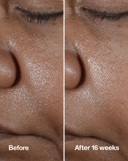 Clinique Smart Clinical Repair™ Wrinkle Correcting Serum